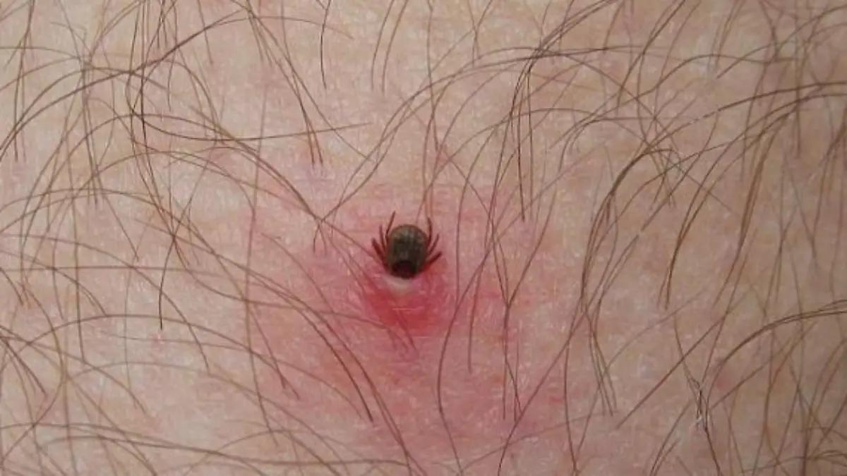 Rickettsiosis cobra tres vidas en Sonora en lo que va de este año